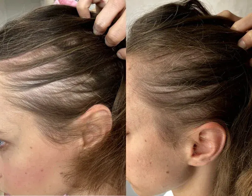 Week 1 and week 12 comparison