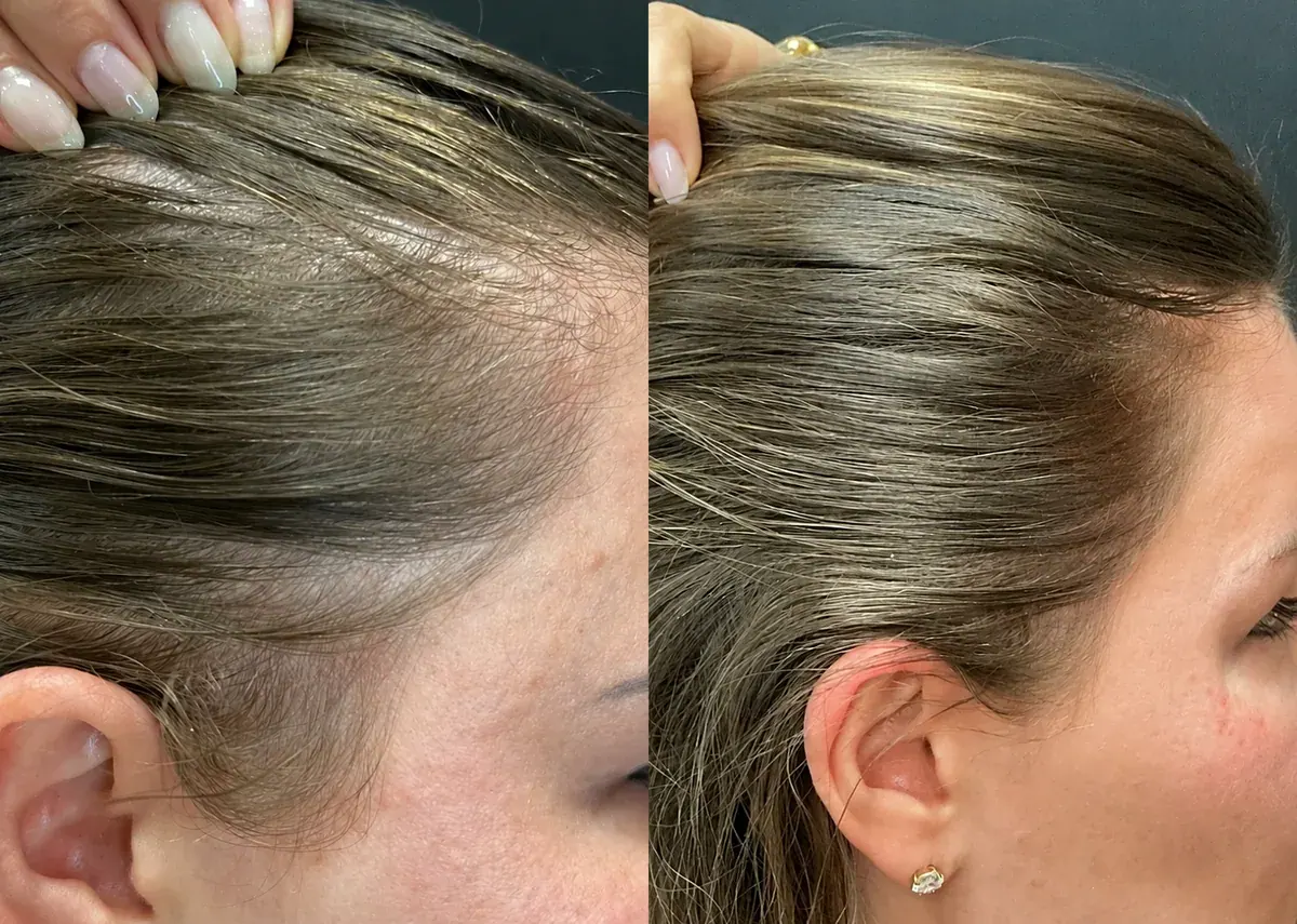 Week 1 and week 12 comparison