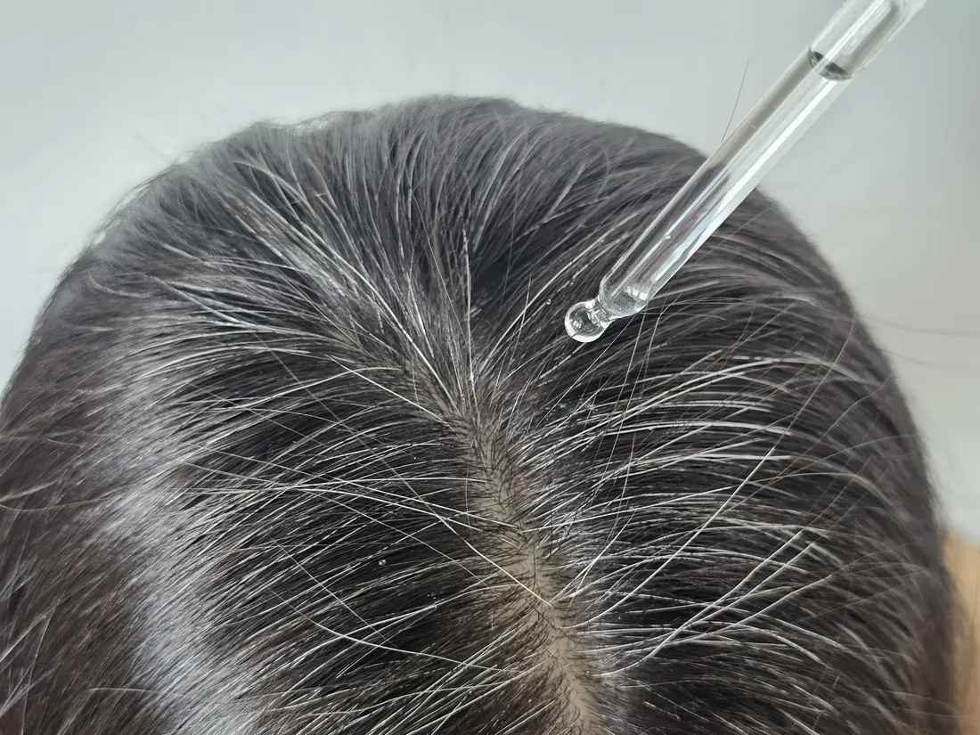 Applying Crowned® serum along the scalp with the dropper